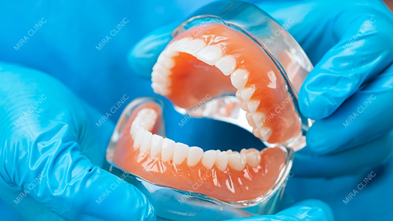 Partial Denture